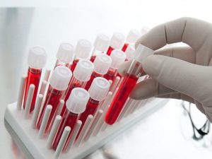 image-1431_blut-blut-fotolia-28459898-c-mario-beauregard