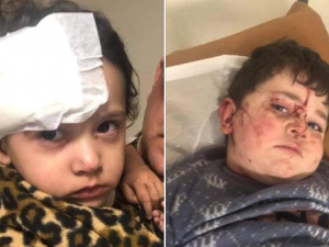 Gəncədə yaralananlardan 10-u məktəblidir