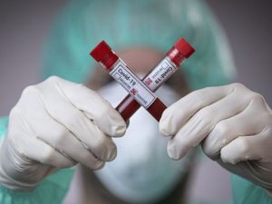 Dünyada 49 milyondan çox insan koronavirusa yoluxub