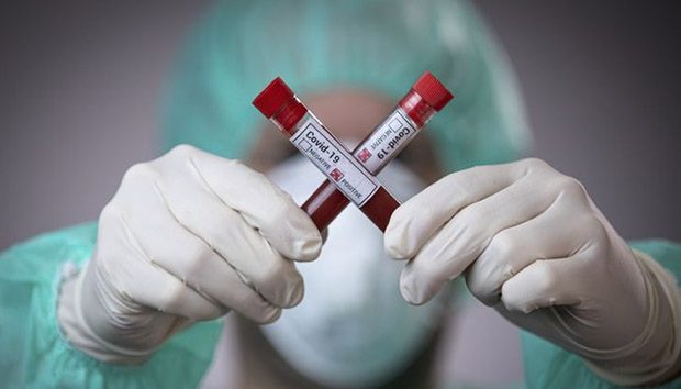 Dünyada 49 milyondan çox insan koronavirusa yoluxub