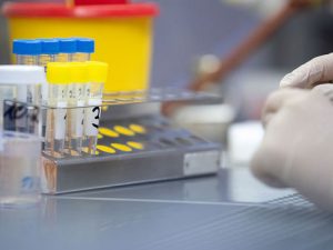 Çin koronavirusun “Britaniya” növünü təyin etmək üçün ekspress-test yaratdı