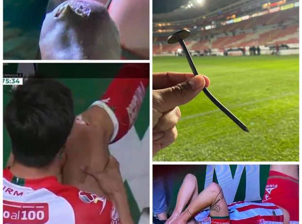 Oyun vaxtı futbolçunun dizinə mismar girdi. FOTO