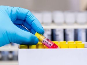 image-coronavirus