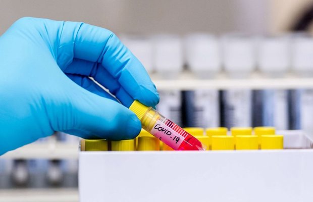 image-coronavirus