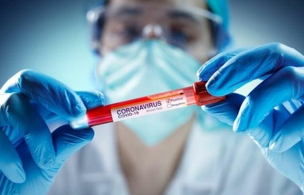 image-koronavirus-covid