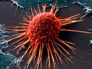 image-xerceng_237476565