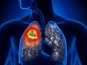 image-depositphotos_48100511_l-pic_32ratio_1200x800-1200x800-41783