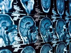 image-depositphotos_5683208_xl-2015-pic_32ratio_900x600-900x600-2313