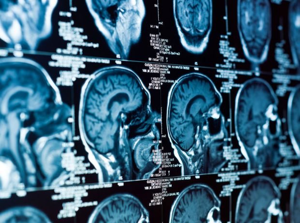 image-depositphotos_5683208_xl-2015-pic_32ratio_900x600-900x600-2313