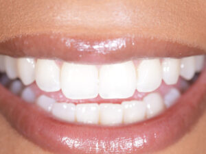 image-67f2c86bae5ac9754258d5bb