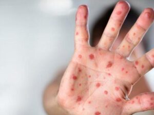 image-qizilca_050418