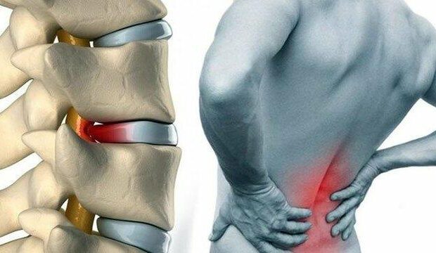 image-2017-09-20-10-41-1140